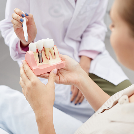 Dentist showing a model of a dental implant to a patient