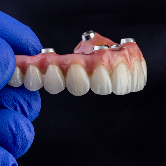Dentist holding an implant denture